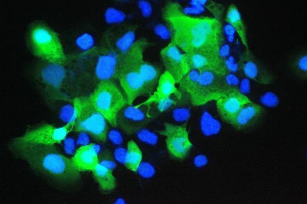 a02369 1 psoriasin primary antibodies if testing 4