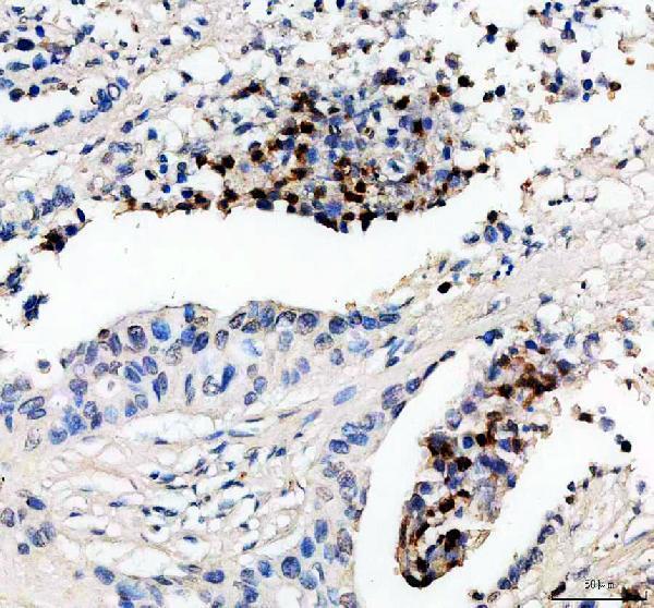 a02371 1 recql5 primary antibodies ihc testing 1
