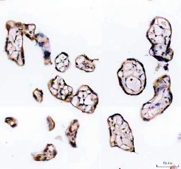 a02371 1 recql5 primary antibodies ihc testing 2