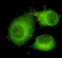 Immunofluorescence analysis of HeLa cells using ATP-citrate synthase Monoclonal Antibody