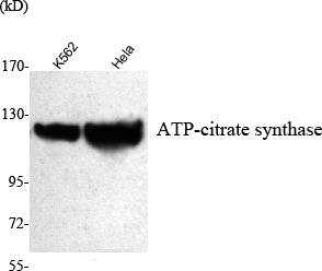 Western Blot analysis using ATP-citrate synthase Monoclonal Antibody against K562, HeLa cell lysate