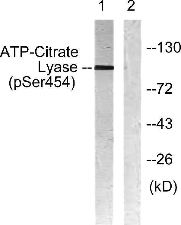 Western blot analysis of lysates from COS7 cells treated with Calyculin 50nM 30', using ATP-Citrate Lyase (Phospho-Ser454) Antibody