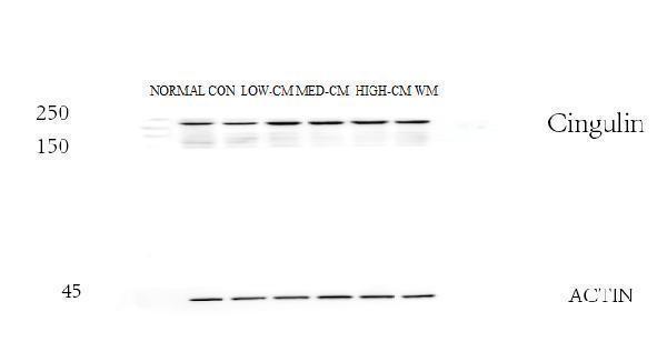 Western blot analysis of Cingulin/CGN using anti-Cingulin/CGN antibody (A02373-1)