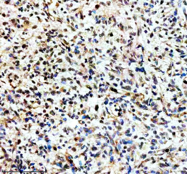 IHC analysis of TERF2IP using anti-TERF2IP antibody (A02374-1)