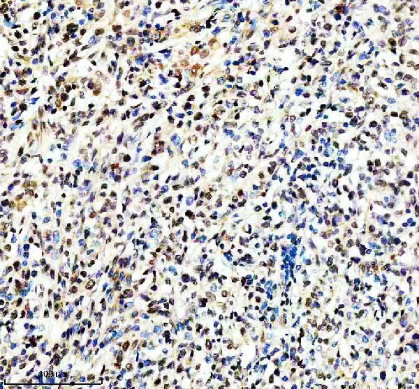IHC analysis of TERF2IP using anti-TERF2IP antibody (A02374-1)