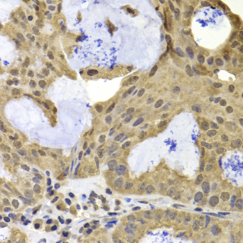 Immunofluorescence analysis of U2OS cells using TERF2IP antibody  at dilution of 1:100