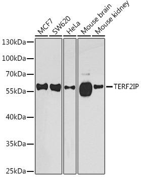 Western blot analysis of extracts of various cell lines, using TERF2IP  antibody  at 1:1000 dilution