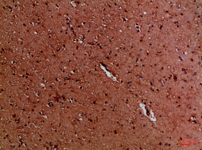 a02376 1 eya1 primary antibodies ihc testing 1