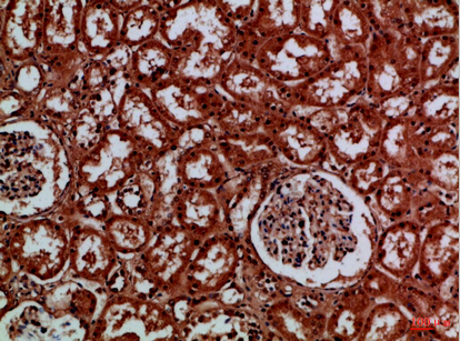 Immunohistochemical analysis of paraffin-embedded Human-kidney, antibody was diluted at 1:100