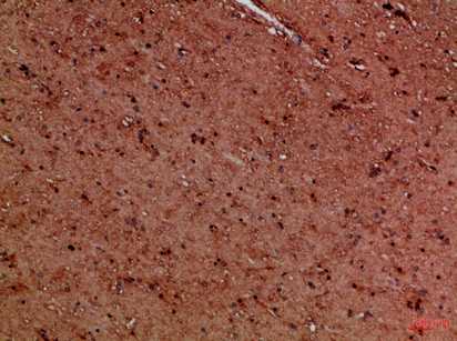 Immunohistochemical analysis of paraffin-embedded Human-brain, antibody was diluted at 1:100
