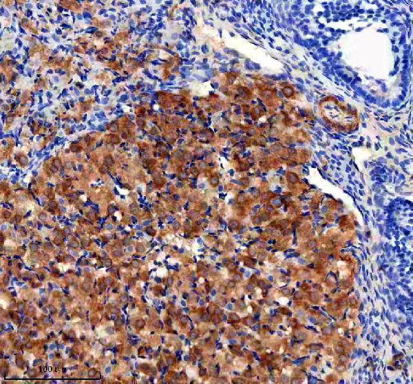 IHC analysis of HLCS using anti-HLCS antibody (A02377-1)