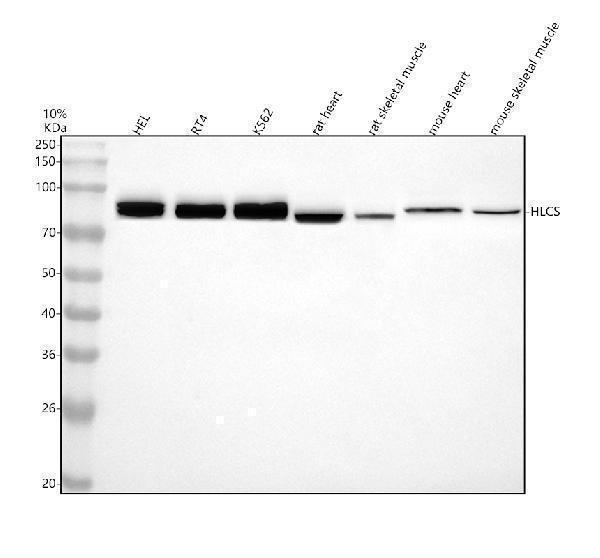 Western blot analysis of HLCS using anti-HLCS antibody (A02377-1)