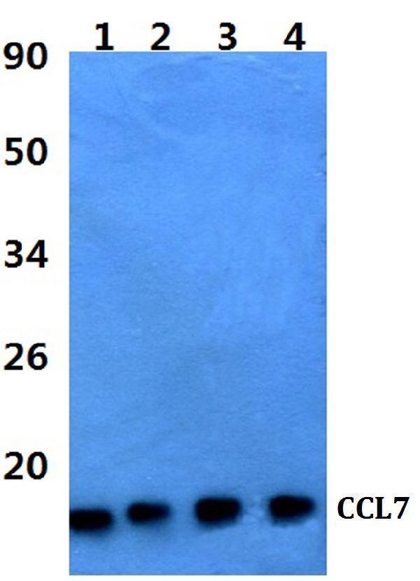 Western blot (WB) analysis of CCL7 polyclonal antibody at 1:500 dilution
Lane1:HEK293T whole cell lysate
Lane2:Raw264