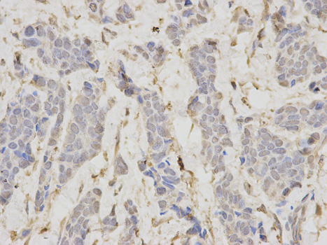 Immunofluorescence analysis of MCF-7 cells using LIG1 antibody 