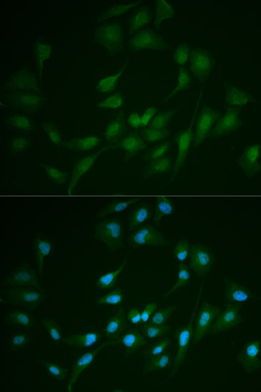 Immunofluorescence analysis of A549 cells using LIG1 antibody 
