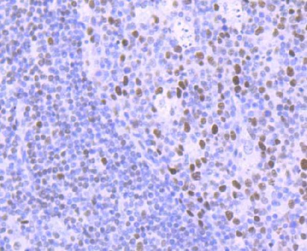 Immunohistochemical analysis of paraffin-embedded human tonsil tissue using anti-DNA Ligase I antibody