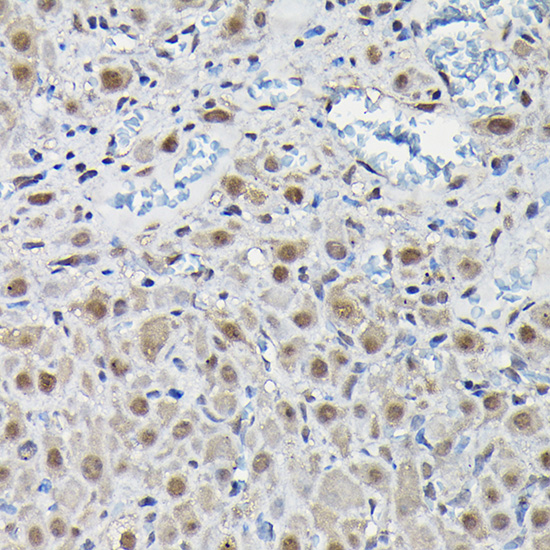 a02382 1 pfkfb3 primary antiboties ihc testing 3