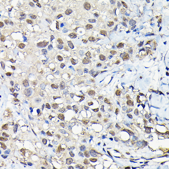a02382 1 pfkfb3 primary antiboties ihc testing 4