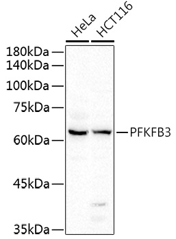 a02382 1 pfkfb3 primary antiboties wb testing 1