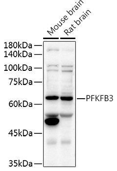a02382 1 pfkfb3 primary antiboties wb testing 2