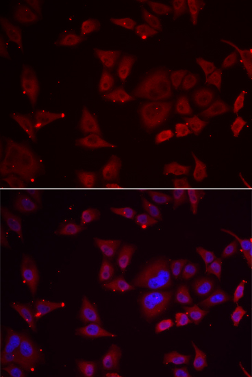 a02382 pfkfb3 primary antiboties if testing 1