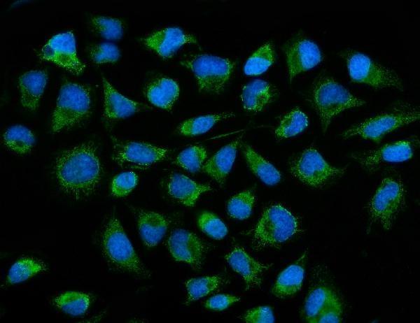 a02383 2 acadm primary antibodies if testing 8