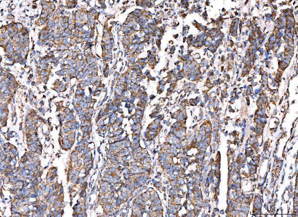 a02383 2 acadm primary antibodies ihc testing 2