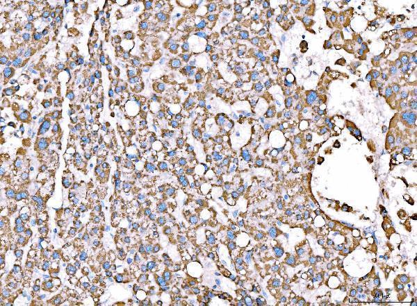 a02383 2 acadm primary antibodies ihc testing 5