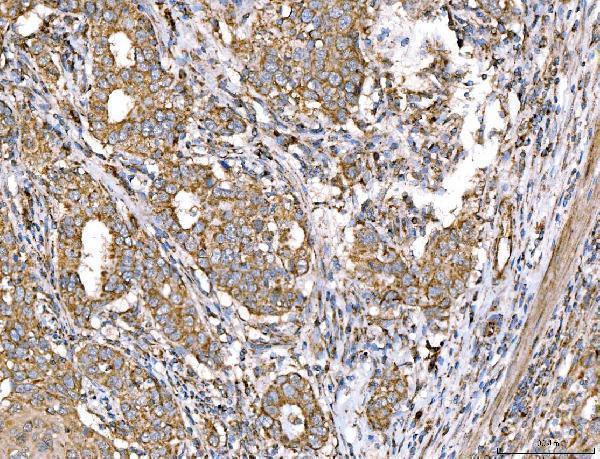 a02383 2 acadm primary antibodies ihc testing 6