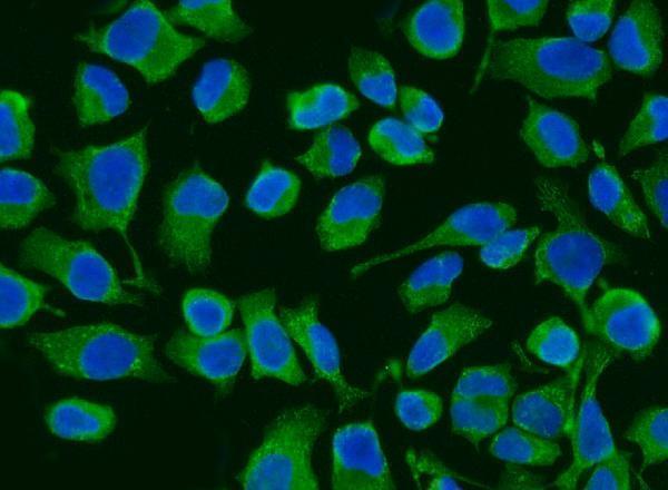 a02383 3 acadm primary antibodies if testing 4