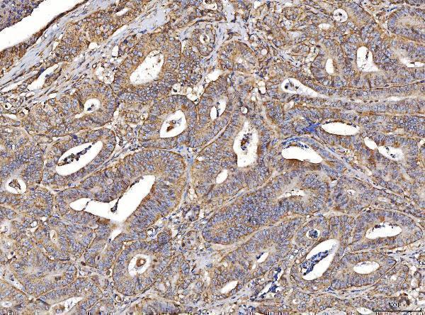  IHC analysis of ACADM/MCAD using anti-ACADM/MCAD antibody (A02383-3)