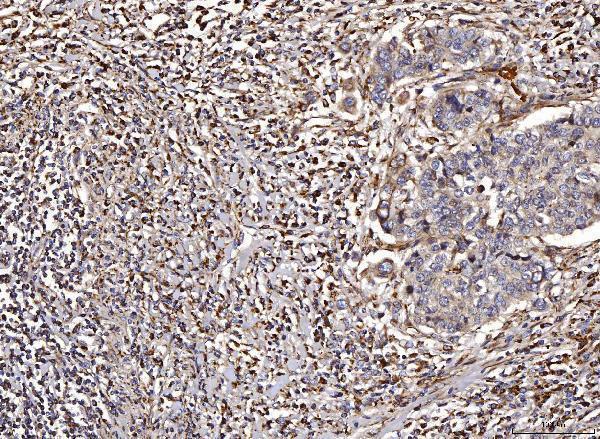  IHC analysis of ACADM/MCAD using anti-ACADM/MCAD antibody (A02383-3)
