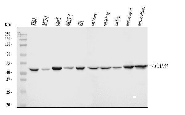  Western blot analysis of ACADM/MCAD using anti-ACADM/MCAD antibody (A02383-3)