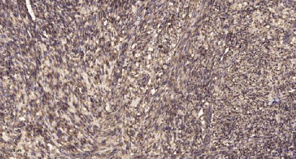 a02383 acadm primary antibodies ihc testing 1
