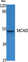 a02383 acadm primary antibodies wb testing 2