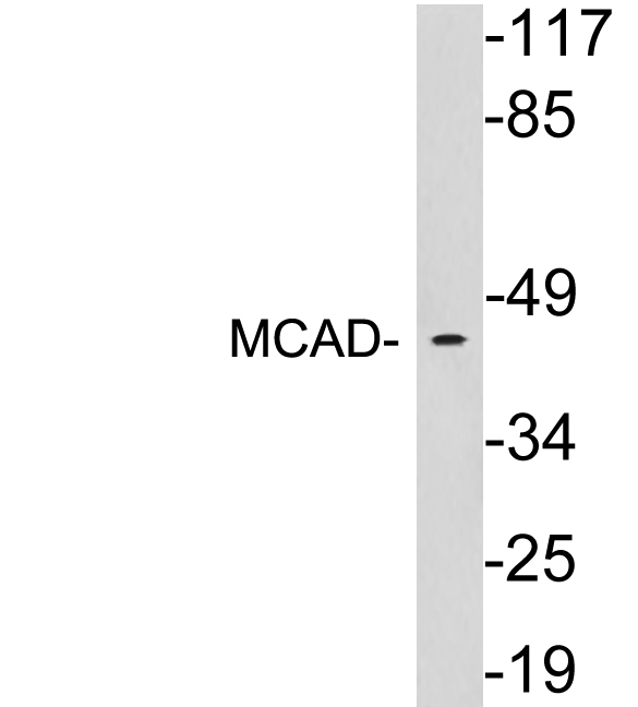 a02383 acadm primary antibodies wb testing 3