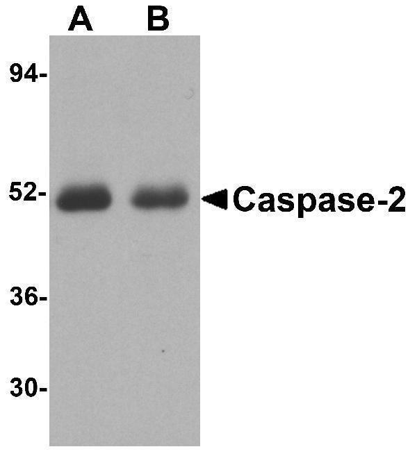 Western blot analysis of Caspase-2 in (A) human thymus tissue and (B) human kidney lysate with Caspase-2 antibody at 1 μg/mL