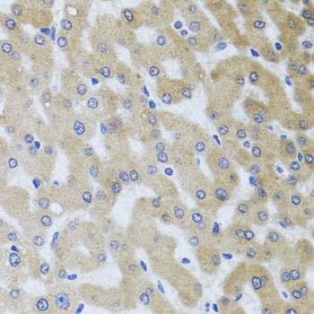 a02385 2 uvrag primary antiboties ihc testing 1