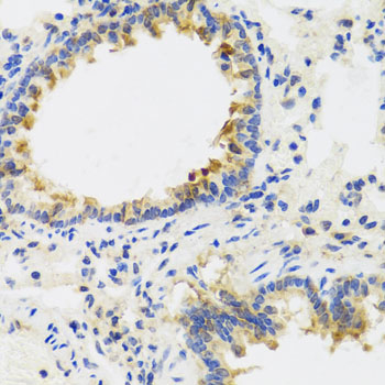 a02385 2 uvrag primary antiboties ihc testing 2