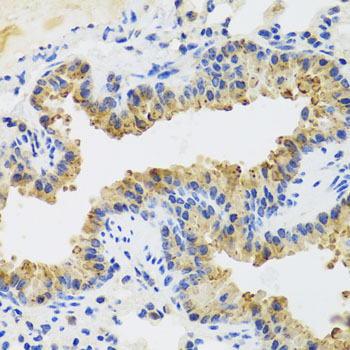 a02385 2 uvrag primary antiboties ihc testing 3