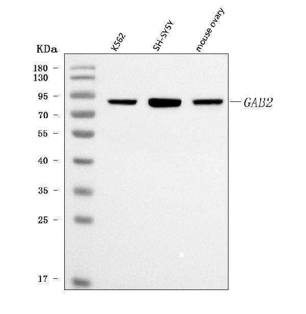 Western blot analysis of GAB2 using anti-GAB2 antibody (A02386-3)