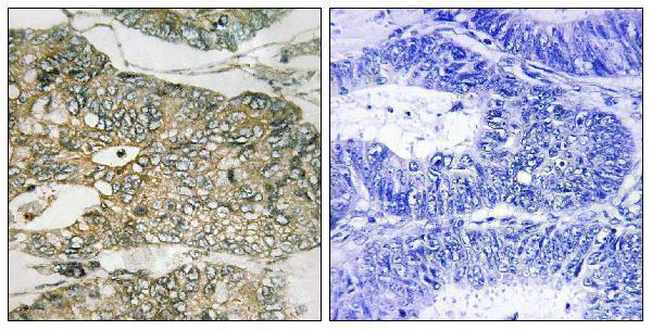 a02386s159 gab2 primary antibodies ihc testing 3