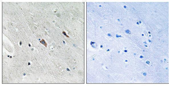 a02386y643 gab2 primary antibodies ihc testing 1