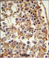 a02387 1 anti fancc antibody c term ihc p testing 3