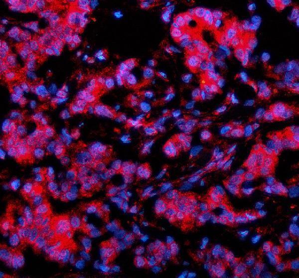 a02388 1 slx4 primary antibodies if testing 1