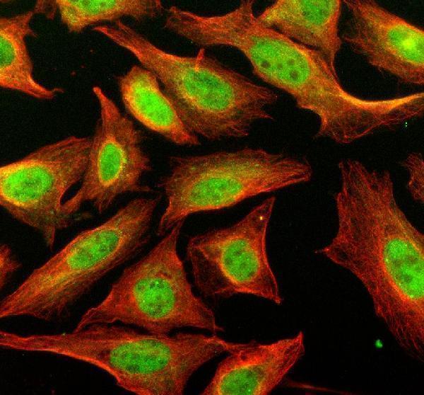 a02388 1 slx4 primary antibodies if testing 2