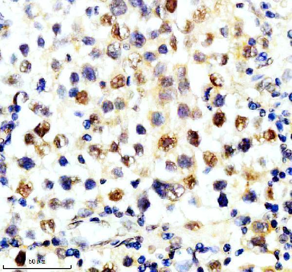 a02388 1 slx4 primary antibodies ihc testing 2