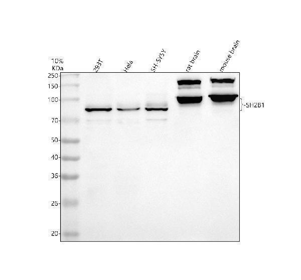 Western blot analysis of SH2B1 using anti-SH2B1 antibody (A02390-1)