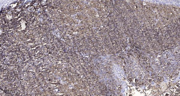 a02391 1 htr3a primary antibodies ihc testing 1
