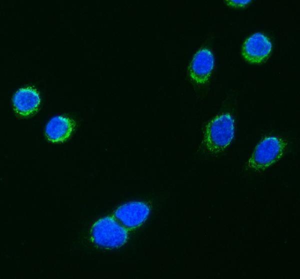 IF analysis of PPP1R15A using anti-PPP1R15A antibody (A02394-2)
